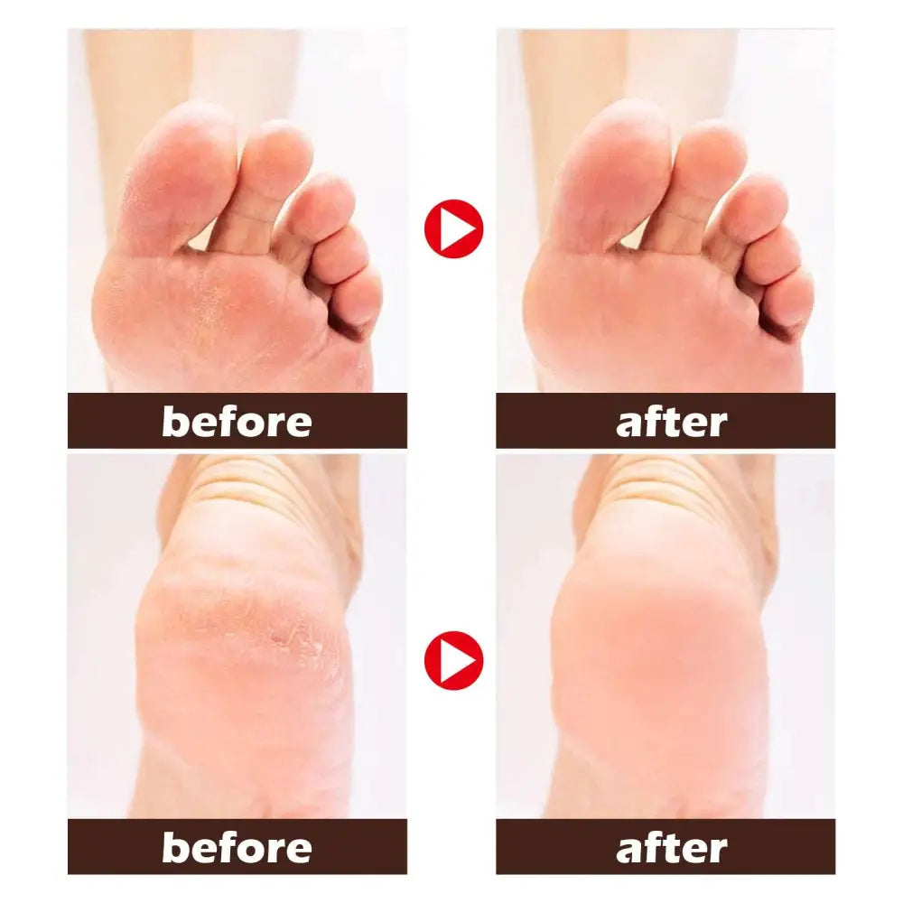 Brown jar of eelhoe natural horse oil foot cream with black lid and gold foil label for cracked feet repair