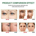 Intensive anti aging essences serum in silver dropper bottles reduces wrinkles fine lines and pigmentation after one use