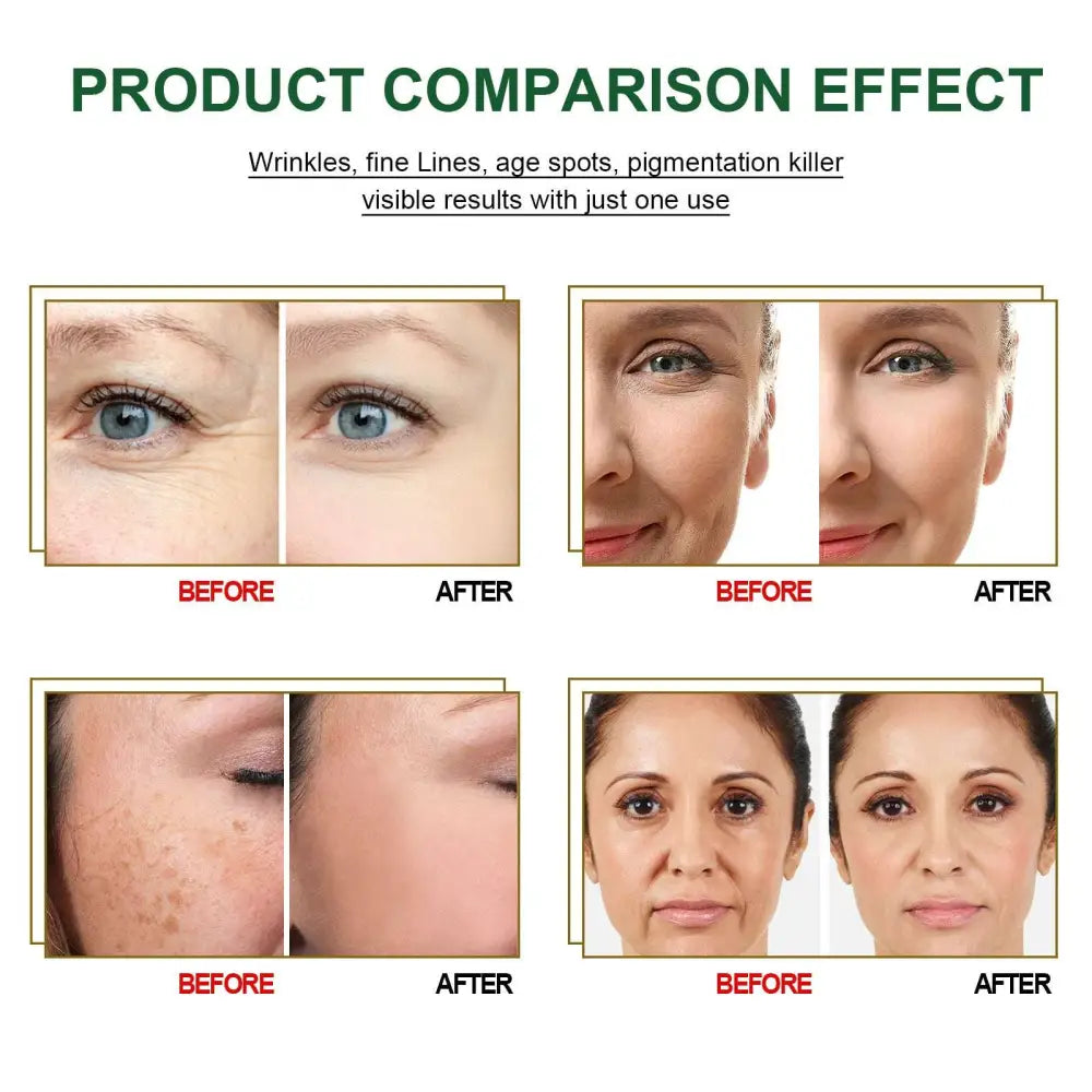 Intensive anti aging essences serum in silver dropper bottles reduces wrinkles fine lines and pigmentation after one use
