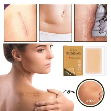 Beige adhesive skin mask patch by jayswing invisible concealer for effective scar covering and skin camouflage