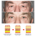 Before and after of a man’s eyes showing reduced wrinkles and brightened skin using men’s anti-aging eye cream with awaken peptide lifting