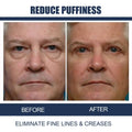 Before and after of an older man showing reduced puffiness and fine lines after using men’s anti-aging eye cream with openeyes awaken peptide
