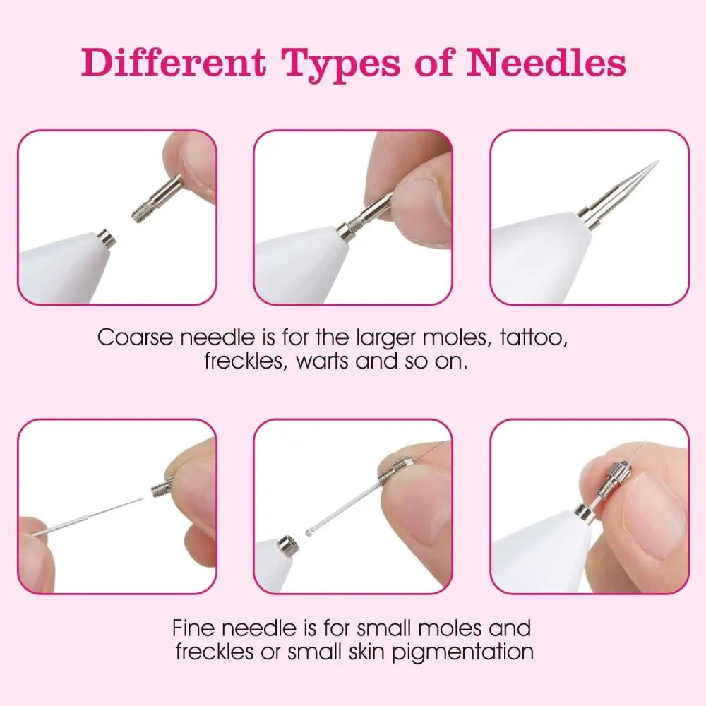 White-handled derma roller needles with metallic tips in various sizes for skin tag repair in portable lcd skin tag repair kit