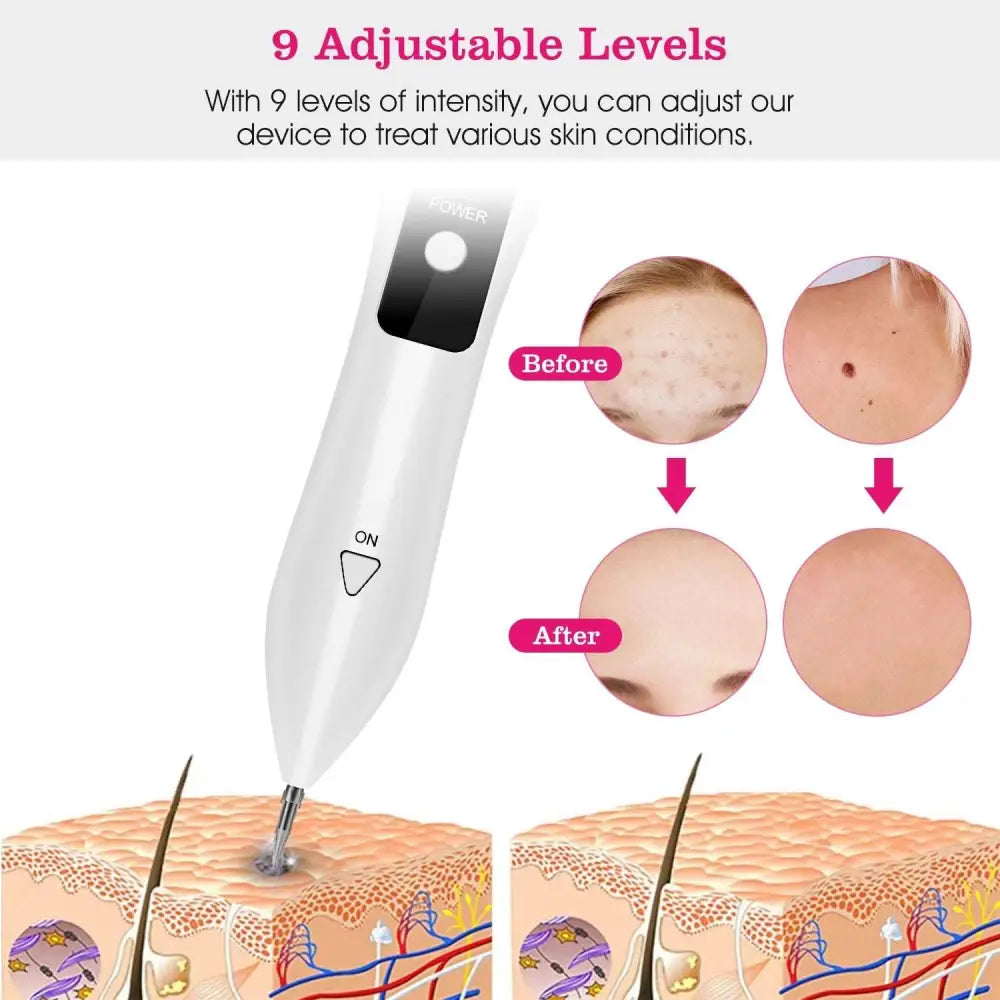 White portable lcd skin tag repair kit handheld device with black power button and adjustable intensity dial for skin tag repair