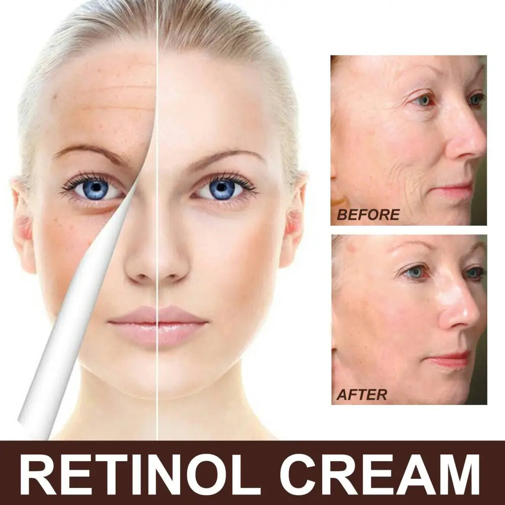 White retinol anti aging skin firming cream tube with sleek modern design and silver cap to reduce fine lines