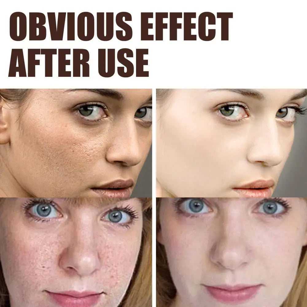Before and after comparison showing retinol anti aging skin firming cream reducing fine lines and improving skin clarity