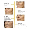 Before and after of a woman using breylee retinol skin firming serum showing reduced fine lines in 28 days