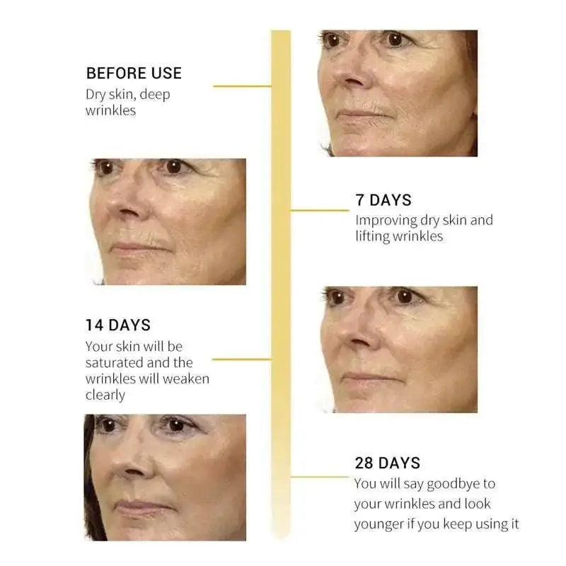 Before and after of a woman using breylee retinol skin firming serum showing reduced fine lines in 28 days