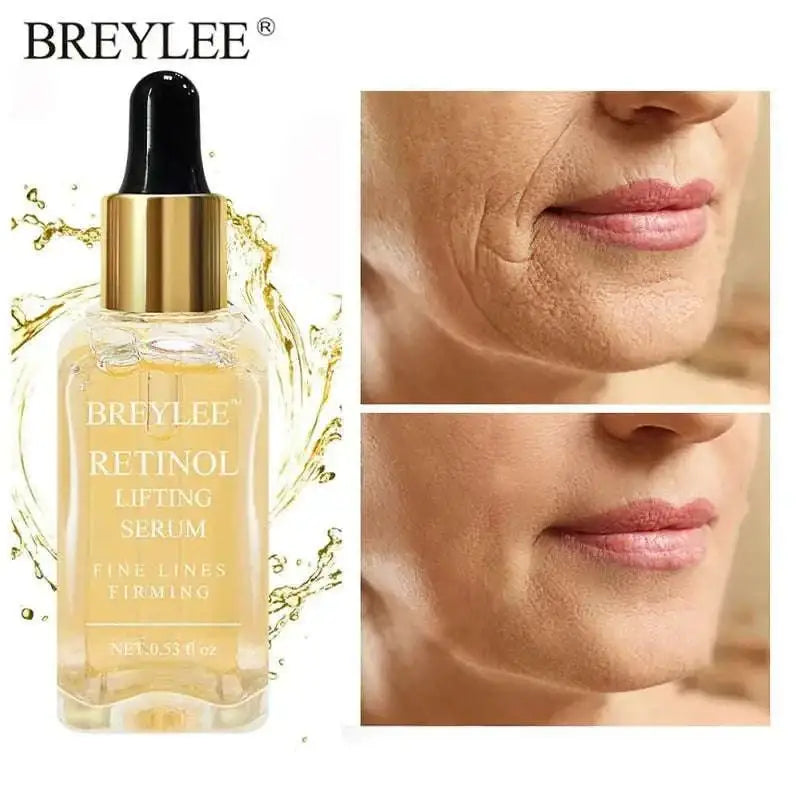 Breylee retinol skin firming serum in a clear glass bottle with gold dropper cap containing golden-yellow liquid for fine lines