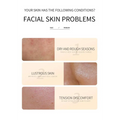 Facial skin problem diagnostic infographic showing dry rough skin, oil imbalance, and tension discomfort for rice skin rejuvenation with essence milk and eye cream targeting dark circles