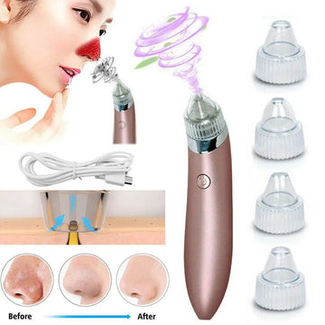 Rose gold electric blackhead vacuum with strong suction, clear circular hole head attachments, and silver metallic band for blood circulation
