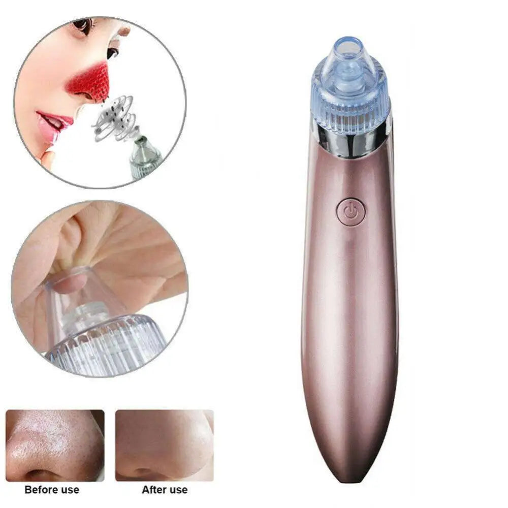 Rose gold electric blackhead vacuum with strong suction featuring a clear plastic circular hole head and silver accent ring