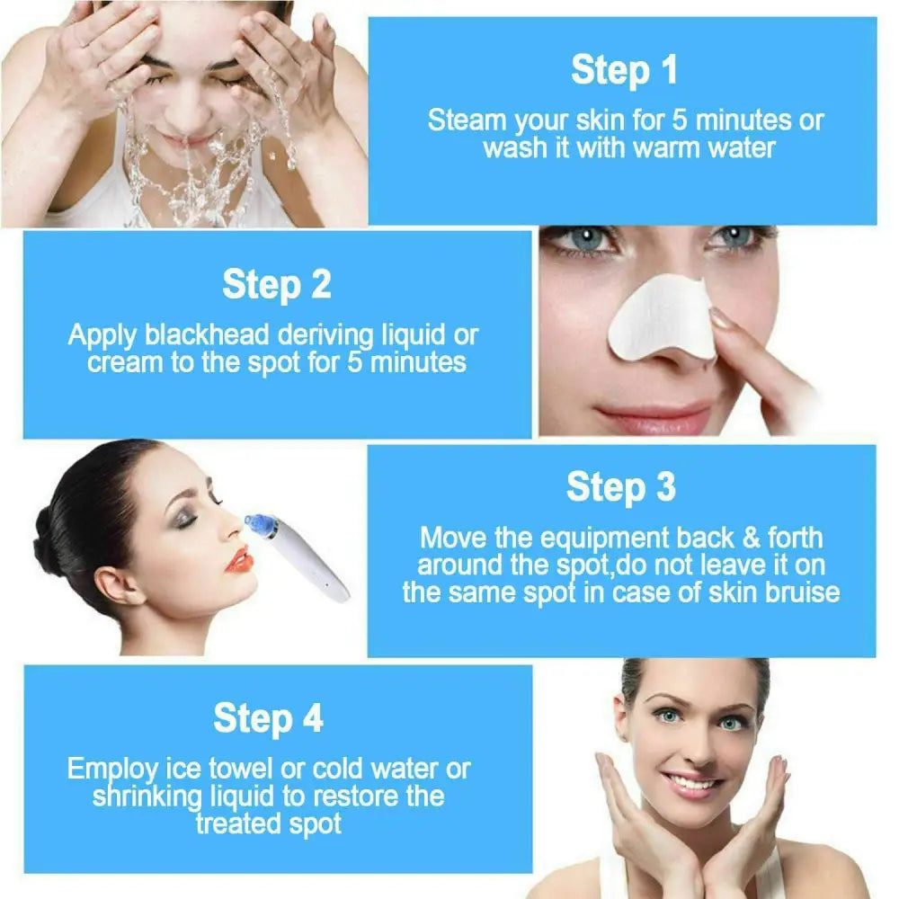 White handheld electric blackhead vacuum with blue circular hole head for strong suction and improved blood circulation