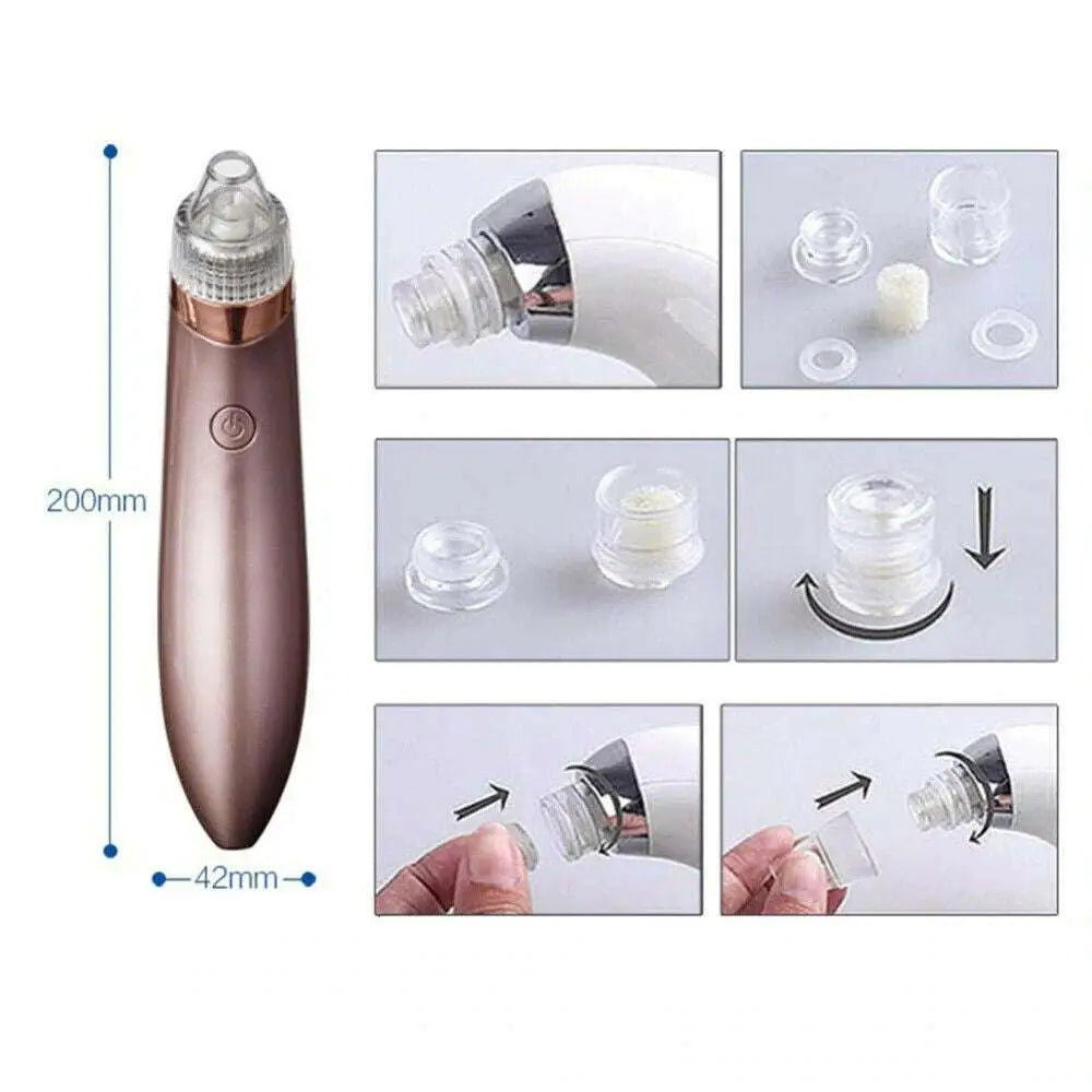 Rose gold electric blackhead vacuum with strong suction, clear circular hole head attachments, and silver metallic band for blood circulation