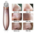 Rose gold electric blackhead vacuum with strong suction circular hole head and clear plastic tip promotes blood circulation