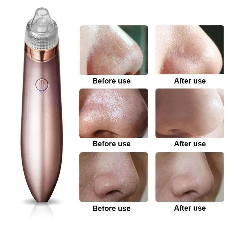 Rose gold electric blackhead vacuum with strong suction circular hole head and clear plastic tip promotes blood circulation