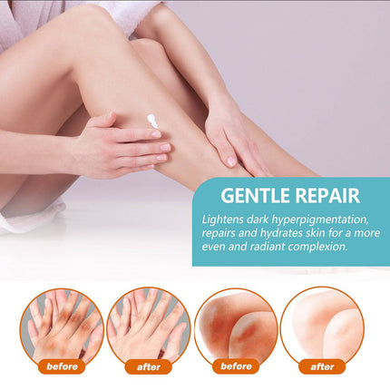 EELHOE Black Echinacea Repair Cream Repair Underarms Arms Knees Joints Dark Moisturizing Whitening Body Cream - Royalessencelux