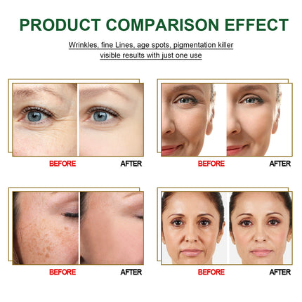 Anti Aging Essences For Moisturizing, Firming Brightening - Royalessencelux