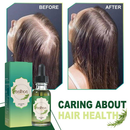 Nourishing Anti-hair Loss Thick Hair Care - Royalessencelux