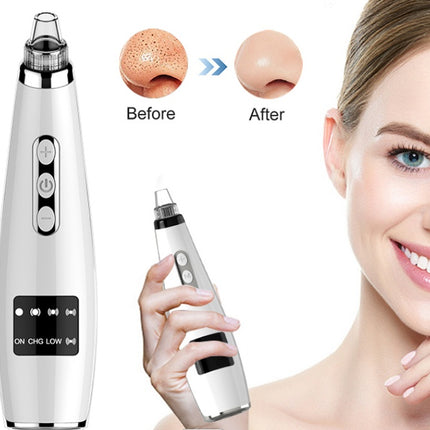 Electric Black Head Suction Instrument Face Cleaner - Royalessencelux