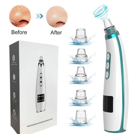 Electric Black Head Suction Instrument Face Cleaner - Royalessencelux