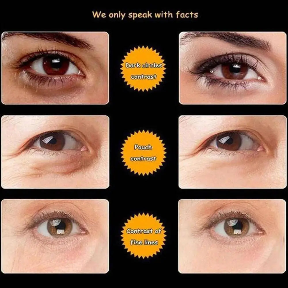 Close-up eye comparisons showing dark circles contrast pouch contrast and fine lines treated by shellfish peptide anti-aging cream