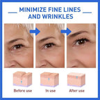 Skin luxury anti-aging neck cream by glo vous derm shown with before and after fine line reduction comparisons