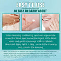 South moon brightening black spot correction spot whitening cream in white tube with pump dispenser
