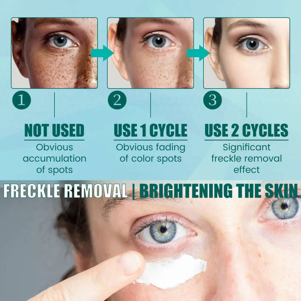 A white creamy facial treatment from south moon brightening applied for black spot correction and spot correction agent effects