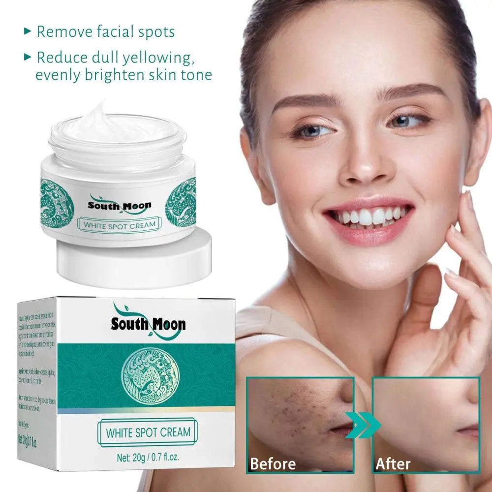 White jar of south moon brightening spot whitening cream with teal label and matching box for black spot correction
