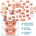 A woman with a bright white smile showing glossy pink lips and neatly aligned teeth using a teeth whitening pen for stained teeth plaque removal