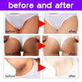 White seamless underwear shown with thigh skin perfecting cream lightens melanin for smooth skin appearance