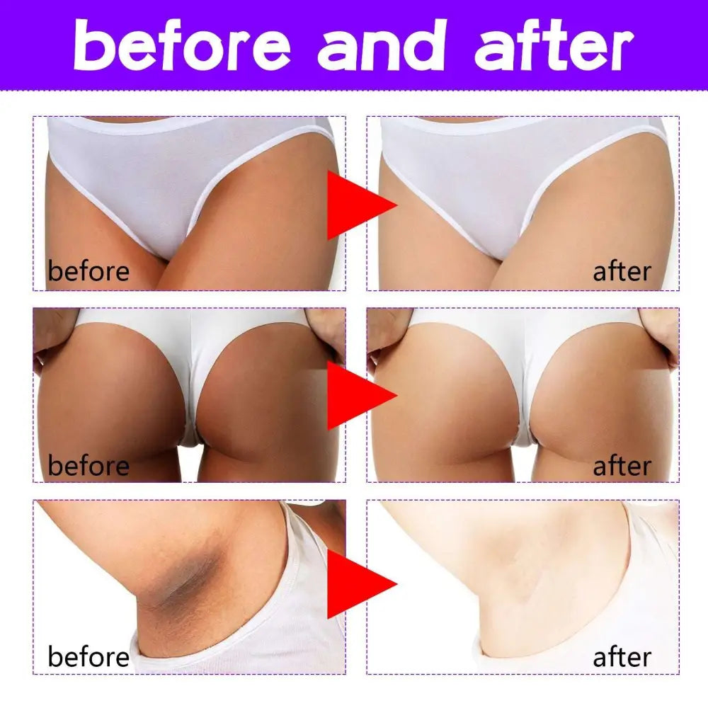 White seamless underwear shown with thigh skin perfecting cream lightens melanin for smooth skin appearance