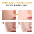 Turmeric exfoliating facial scrub for dark spots shown in before and after comparison demonstrating dark spot fading effects