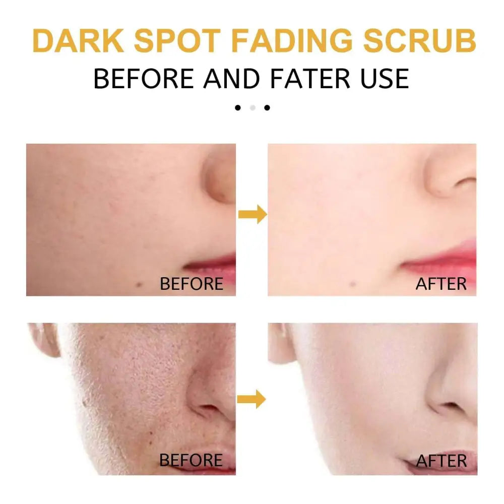 Turmeric exfoliating facial scrub for dark spots shown in before and after comparison demonstrating dark spot fading effects